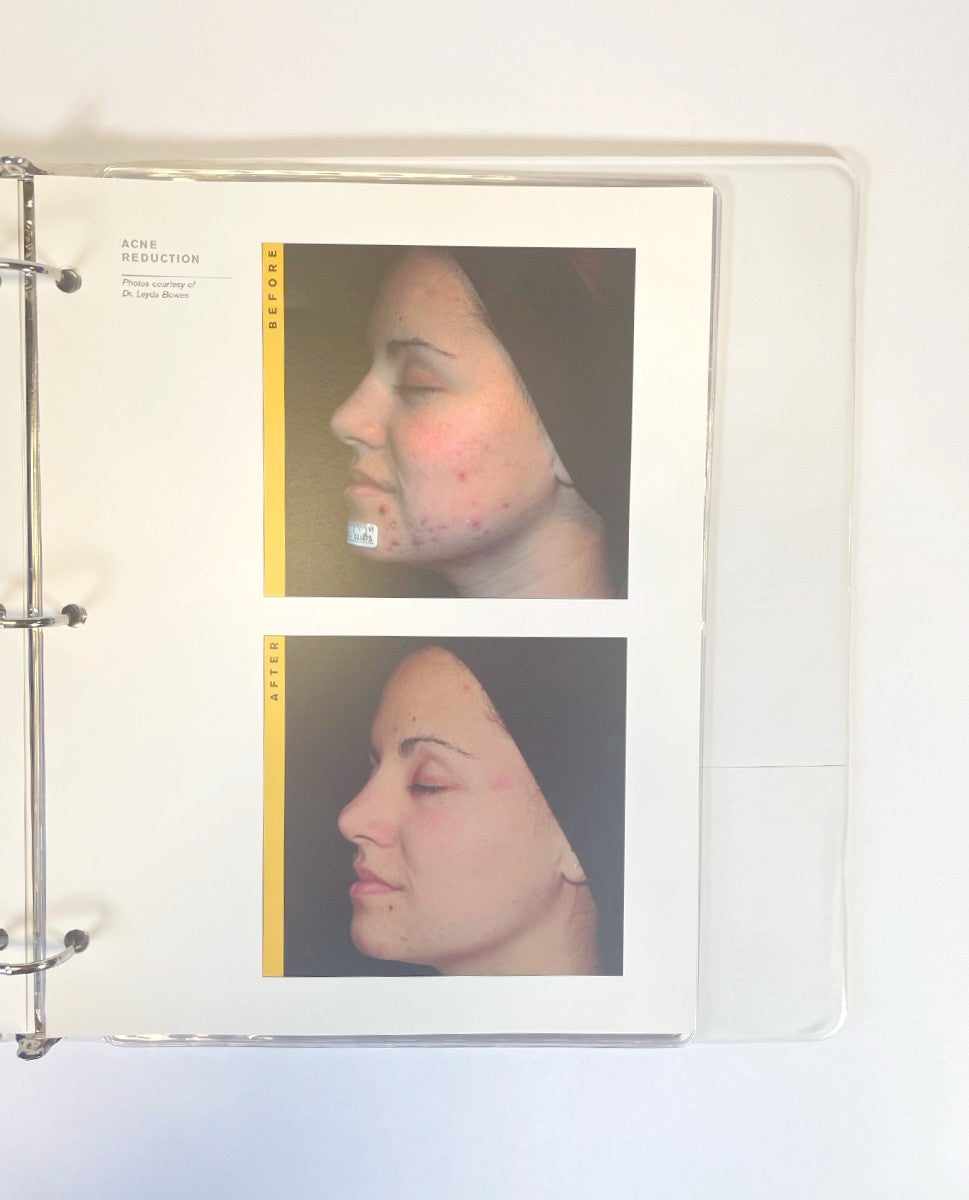 LaserScope Before and After Book Training Guide Manual