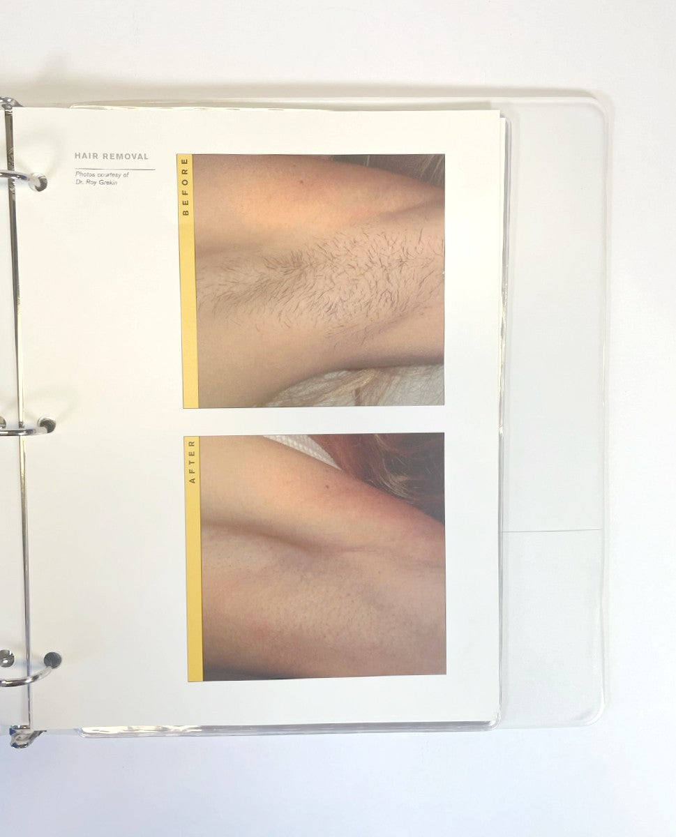 LaserScope Before and After Book Training Guide Manual