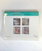 Vaser Shape Brochure Book