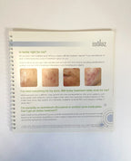 isolaz Effective Acne Treatment for Dramatically Clearer Skin