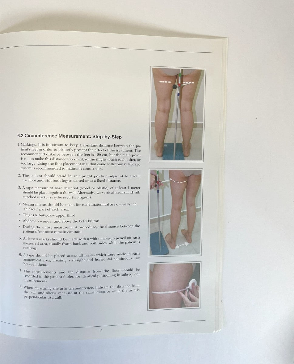 Syneron Clinical Evaluation of the Velashape Patient