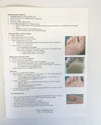 Cutera Excel Laser Vascular Treatment Guidelines 2012 19-400-5931 Rev.F