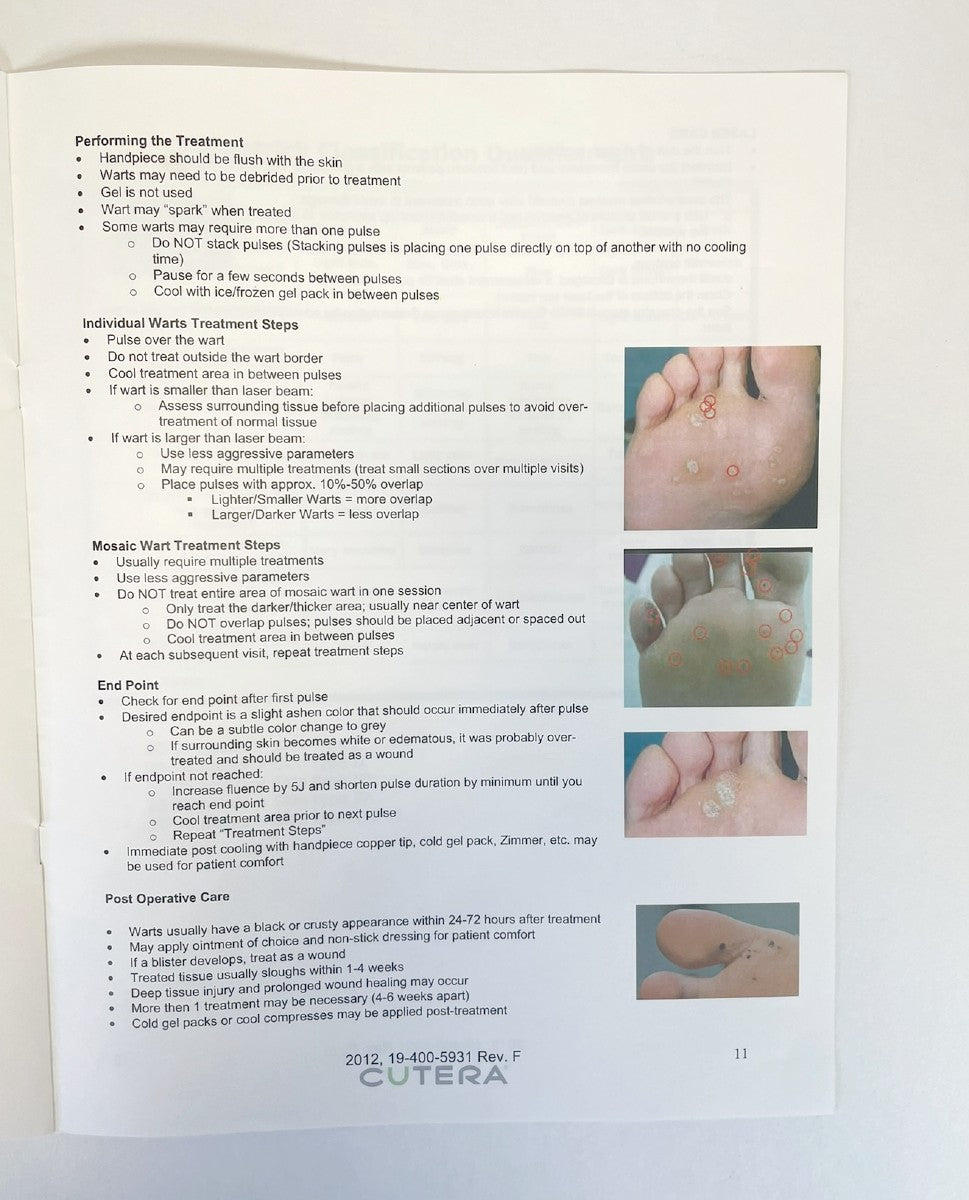 Cutera Excel Laser Vascular Treatment Guidelines 2012 19-400-5931 Rev.F