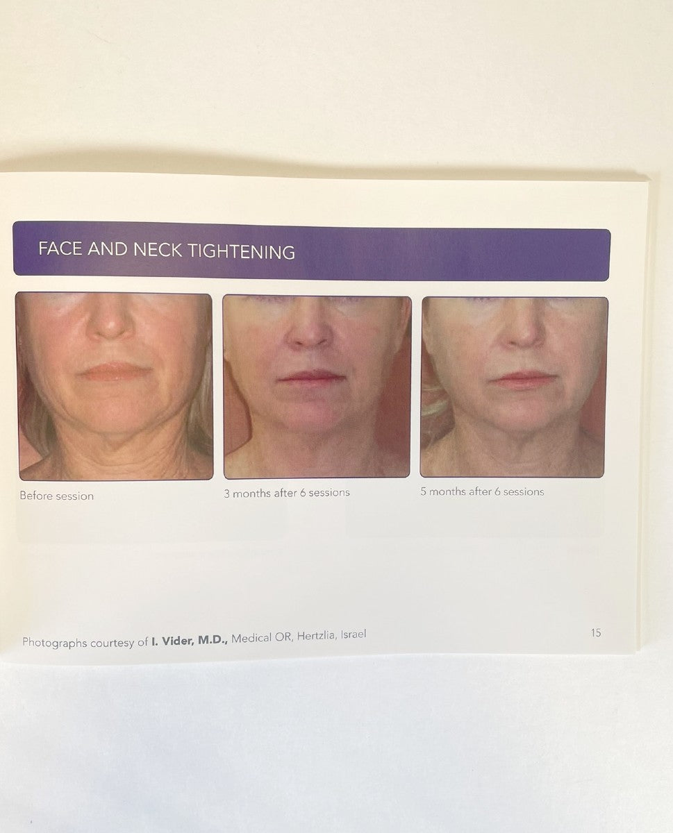 ENDYMED, BEFORE & AFTER 3DEEP RF TREATMENT PHOTOS BOOKLET, 2015