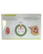 VIVEVE, LAXITY TREATMENT MAP SHEET