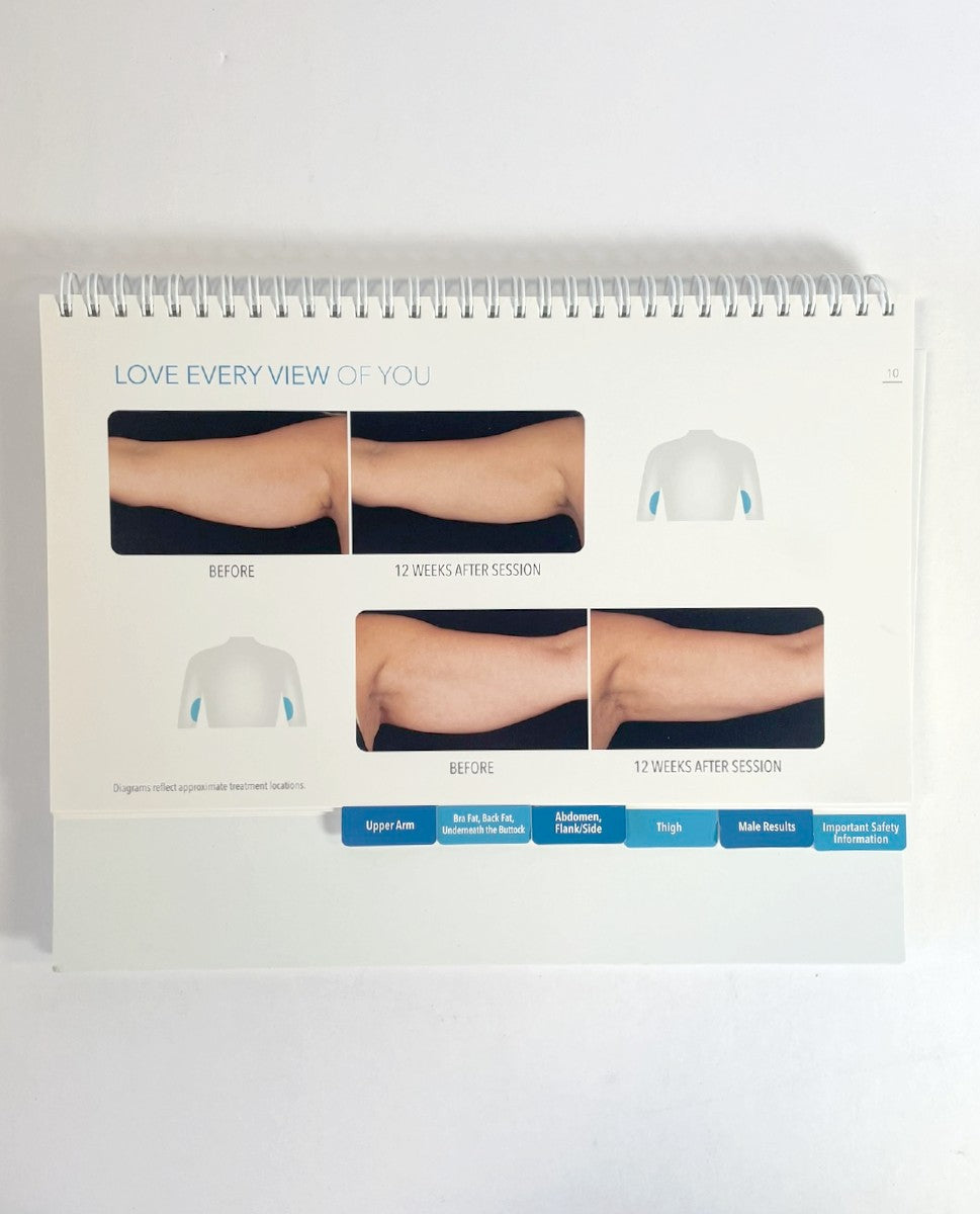 Zeltiq Coolsculpting Freeze Away Fat Guide Book Brochure