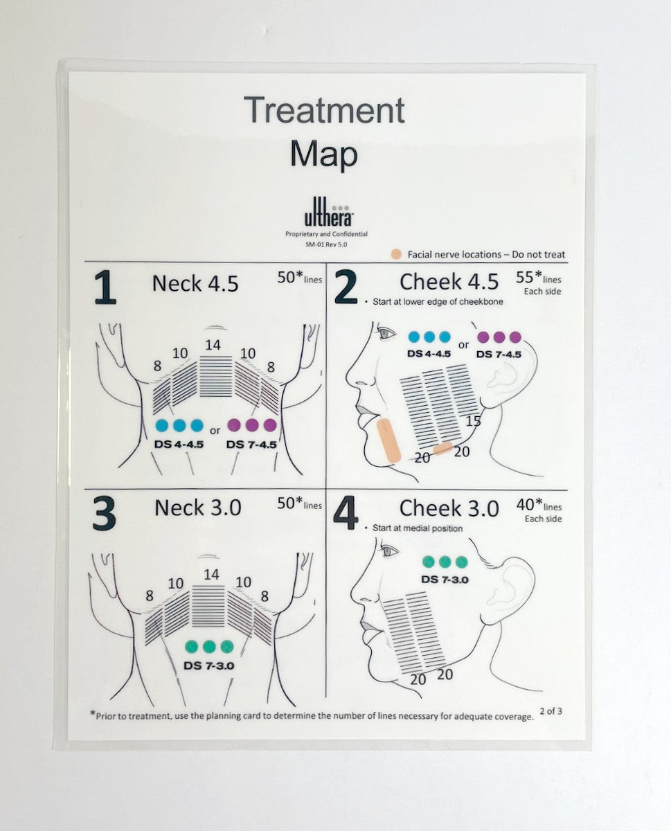 Ulthera, Treatment Map, to Neck, Cheek, lateral orbit, brow, and infraorbital, Guide (1 sheet) P/N: SM-01 Rev 5.0