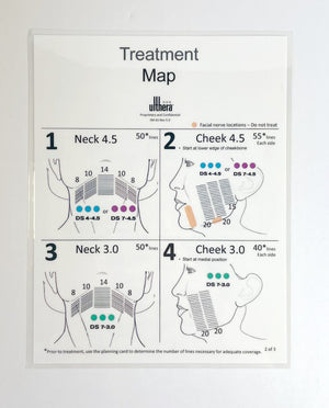 Ulthera, Treatment Map, to Neck, Cheek, lateral orbit, brow, and infraorbital, Guide (1 sheet) P/N: SM-01 Rev 5.0