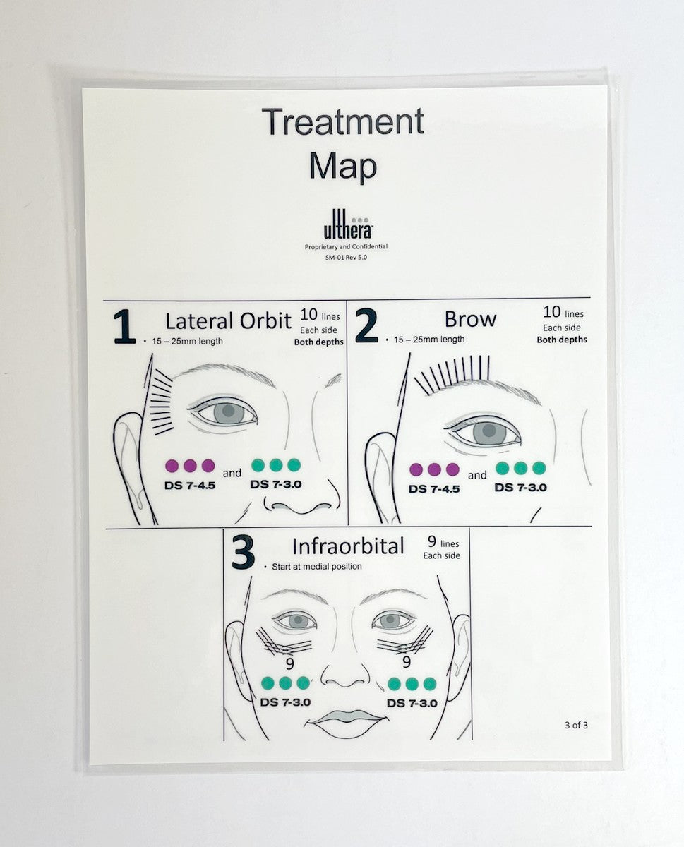 Ulthera, Treatment Map, to Neck, Cheek, lateral orbit, brow, and infraorbital, Guide (1 sheet) P/N: SM-01 Rev 5.0