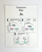 Ulthera, Treatment Map, to Neck, Cheek, lateral orbit, brow, and infraorbital, Guide (1 sheet) P/N: SM-01 Rev 5.0