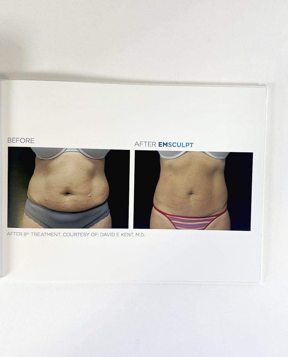 BTL EMsculpt Build Muscle & Sculpt Your Body Lift Buttock Non-Invasively 799-77EMCBABENUS102 btl