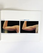 BTL EMsculpt Build Muscle & Sculpt Your Body Lift Buttock Non-Invasively 799-77EMCBABENUS102 btl