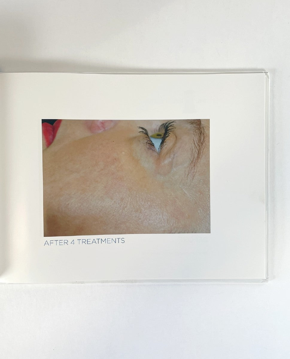 BTL, EXILIS SYSTEM, P/N 715-74EXBABOOKEN100, GALLERY BOOK