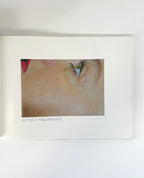 BTL, EXILIS SYSTEM, P/N 715-74EXBABOOKEN100, GALLERY BOOK
