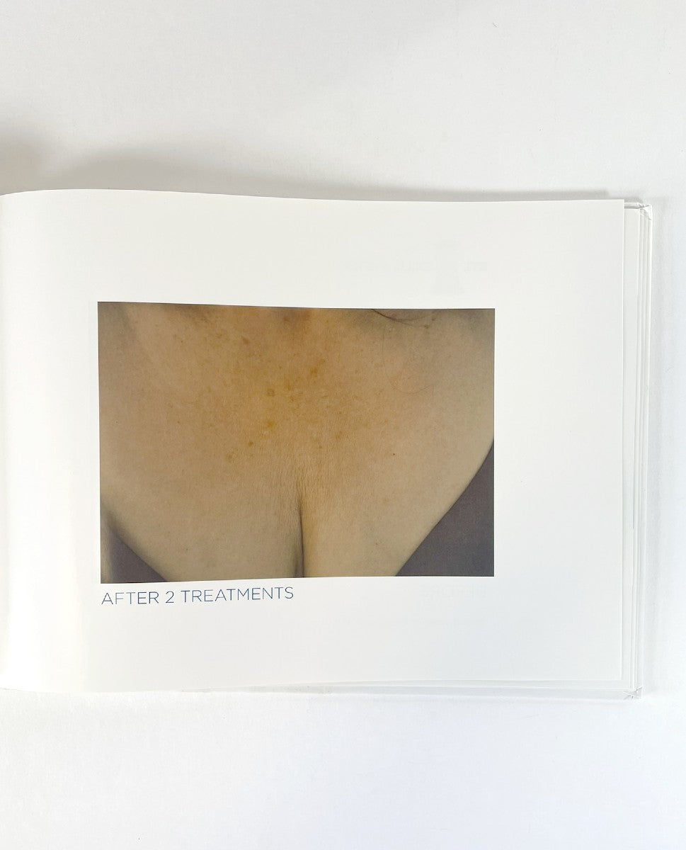 BTL, EXILIS SYSTEM, P/N 715-74EXBABOOKEN100, GALLERY BOOK