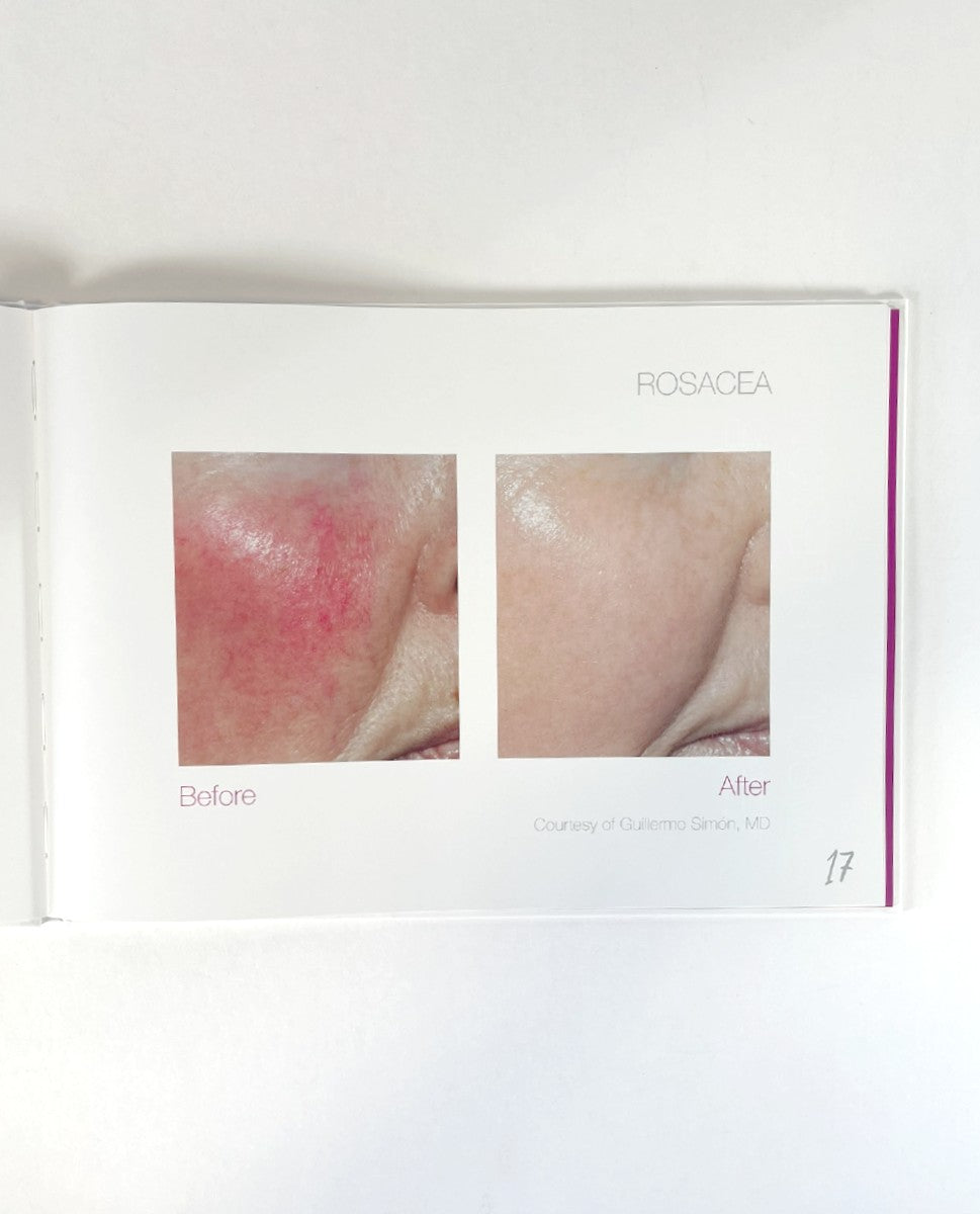 CANDELA, Nordlys, REVEAL YOUR INNER BEAUTY, PU00963EN-NA, 2019