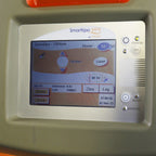 Refurbished 2008 Cynosure SmartLipo MPX Non-Invasive Body Sculpt Laser System