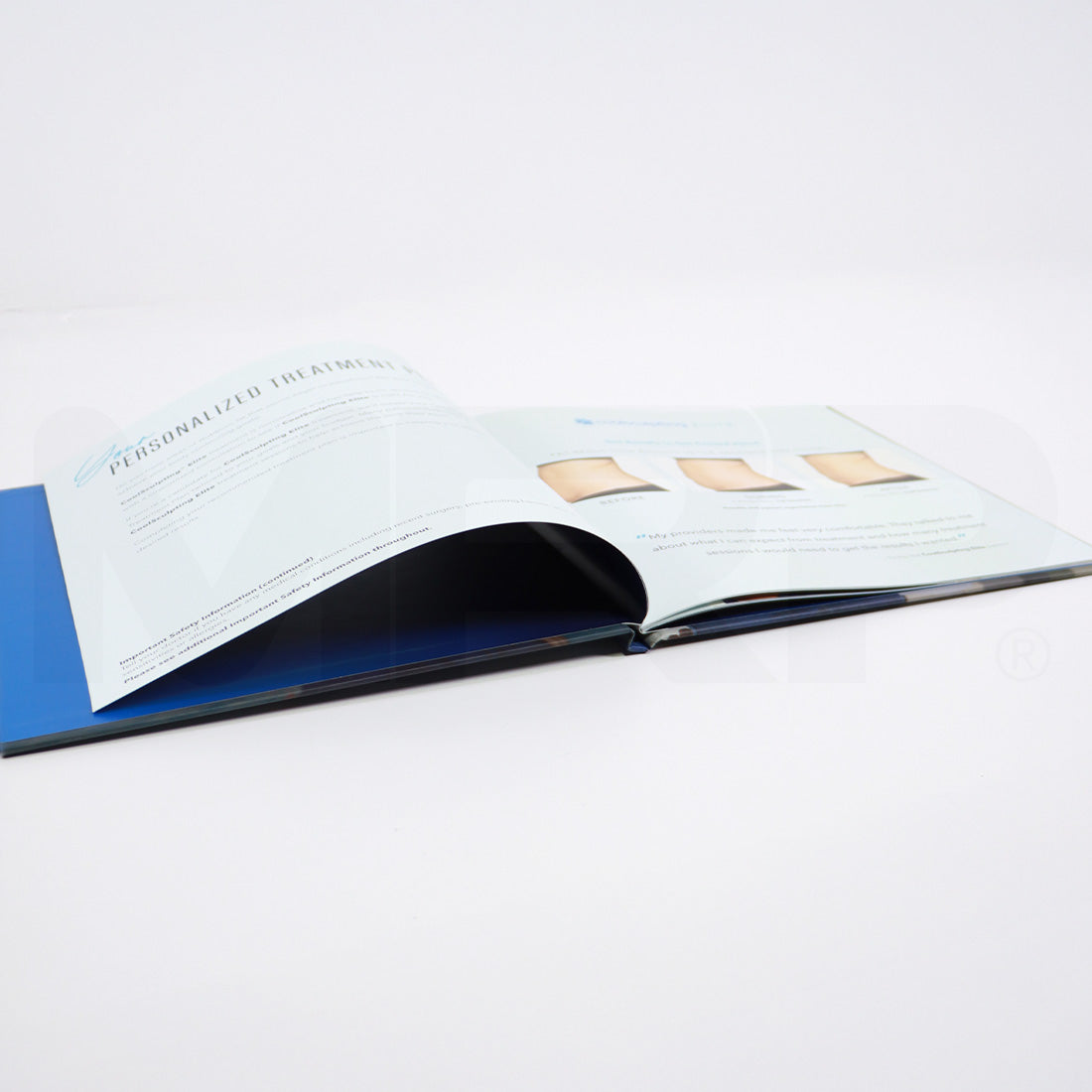 CoolSculpting Elite Real Patient Real Results Information Booklet