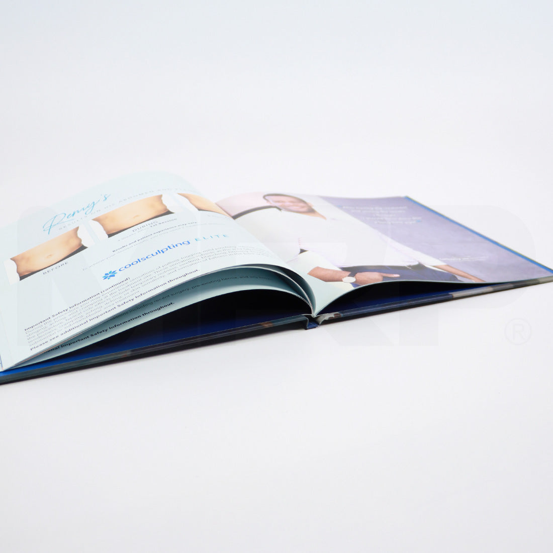 CoolSculpting Elite Real Patient Real Results Information Booklet