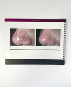 Candela GentleMax Pro A Before and After Booklet Marketing Booklet PB76861EN-NA