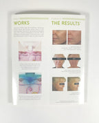 Venus Versa Reduce Sings of Premature Aging Brochure 29 pack