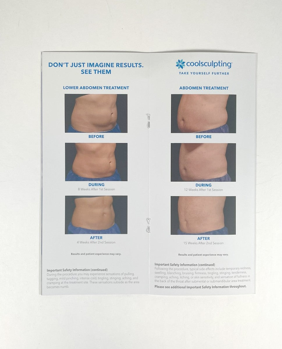 Zeltiq CoolSculpting Take Yourself Further Brochure 12pc