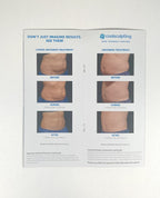 Zeltiq CoolSculpting Take Yourself Further Brochure 12pc