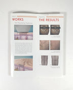 Venus Viva Reduce Signs of Skin Damage Brochure