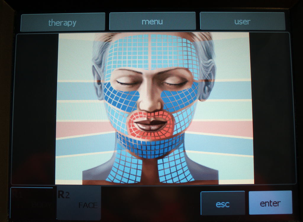 2011 BTL Exilis RF Wrinkle Tightening /w XP 2 & Large Handpieces