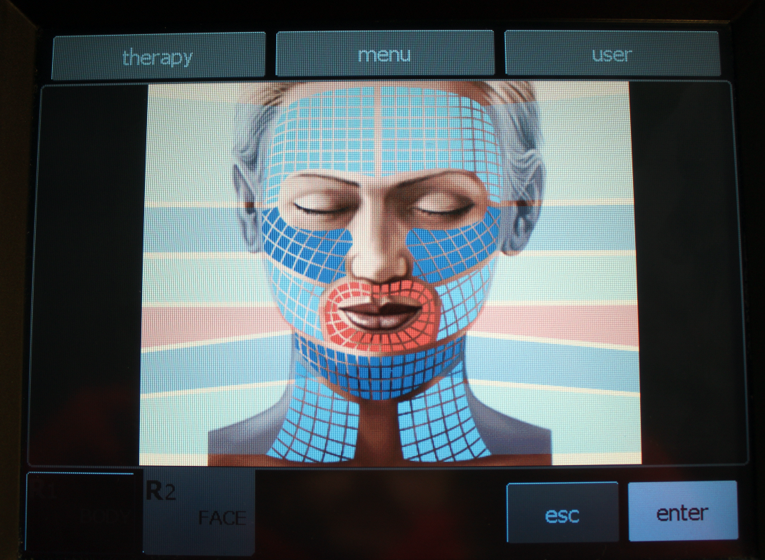 2011 BTL Exilis RF Wrinkle Tightening /w XP 2 & Large Handpieces