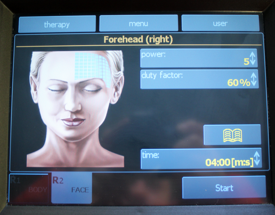 2011 BTL Exilis RF Wrinkle Tightening /w XP 2 & Large Handpieces