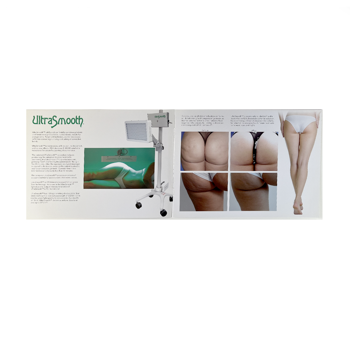 Ward Photonics UltraSmooth, “The very best treatment for Cellulite” introduce Booklet (8 pack), MKT-171017-01, 2019