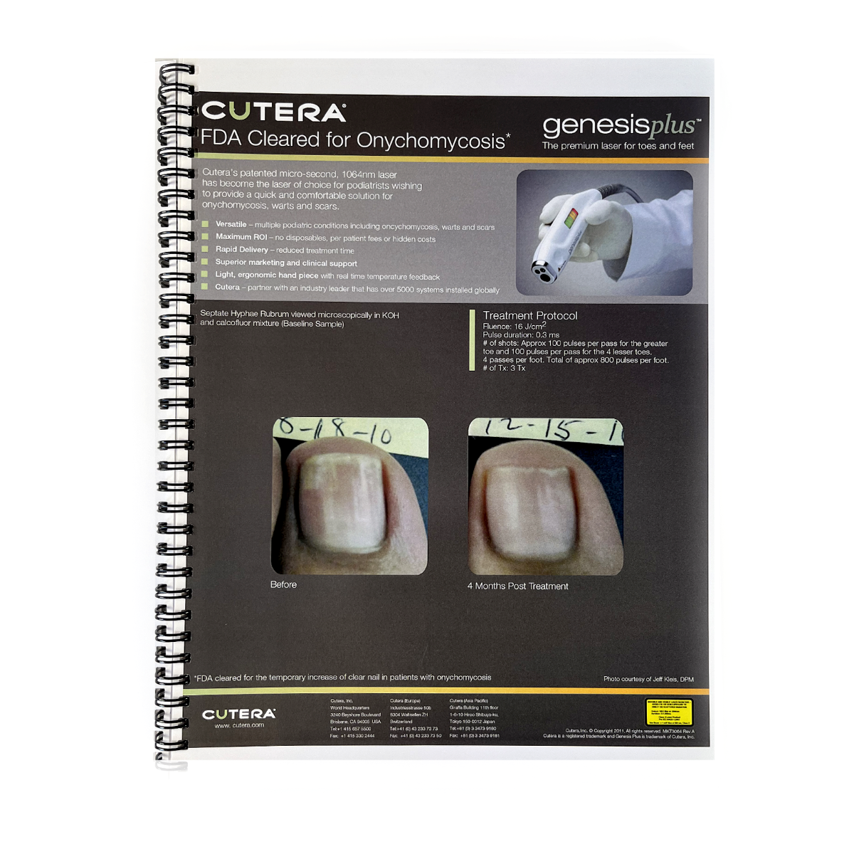 Cutera Case Card Booklet Lasers and Light Cleared for Onychomycosis and Pigmentation Treatment for Skin types MKT3064 Rev. A