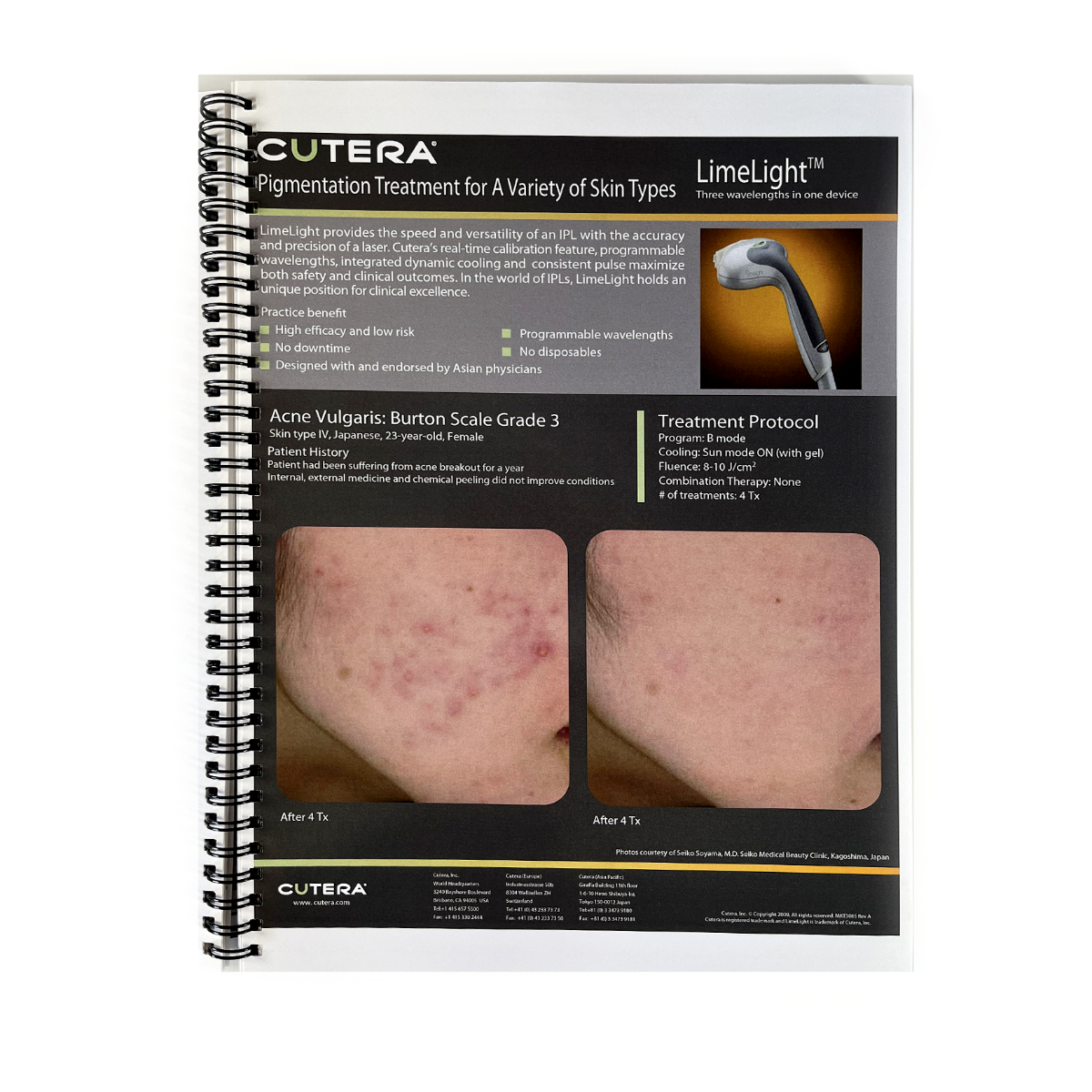 Cutera Case Card Booklet Lasers and Light Cleared for Onychomycosis and Pigmentation Treatment for Skin types MKT3064 Rev. A