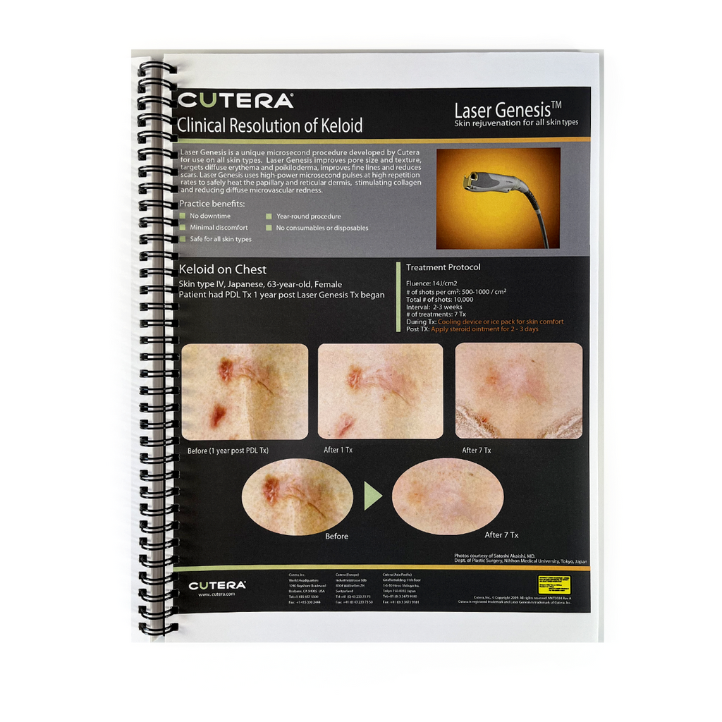 Cutera Case Card Booklet Lasers and Light Cleared for Onychomycosis and Pigmentation Treatment for Skin types MKT3064 Rev. A