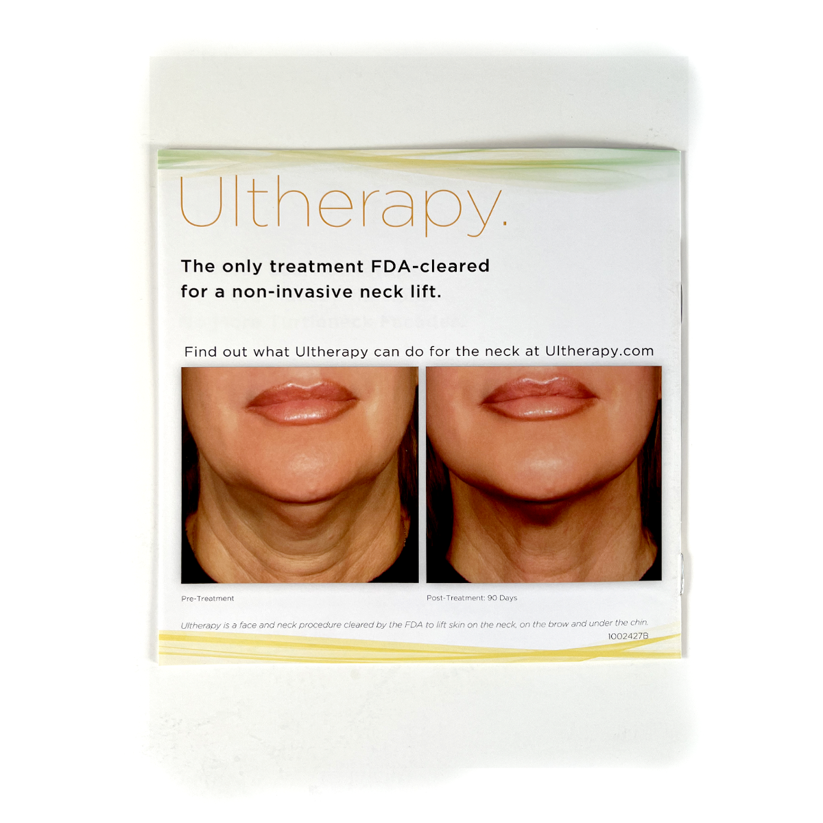 Ulthera Ultherapy "In With A New Neck" Patient Office Display Brochure (x13 Pcs)