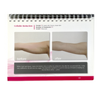 Viora Reaction Cellulite Reduction Client Reference Handbook Display 1