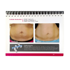 Viora Reaction Cellulite Reduction Client Reference Handbook Display 1