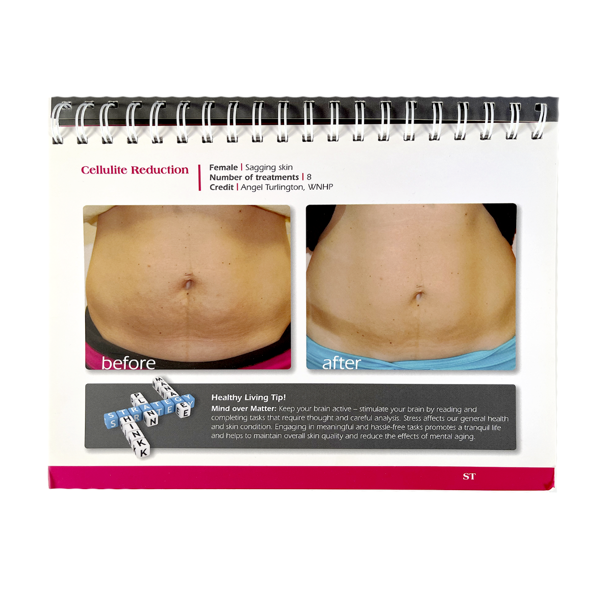Viora Reaction Cellulite Reduction Client Reference Handbook Display 1