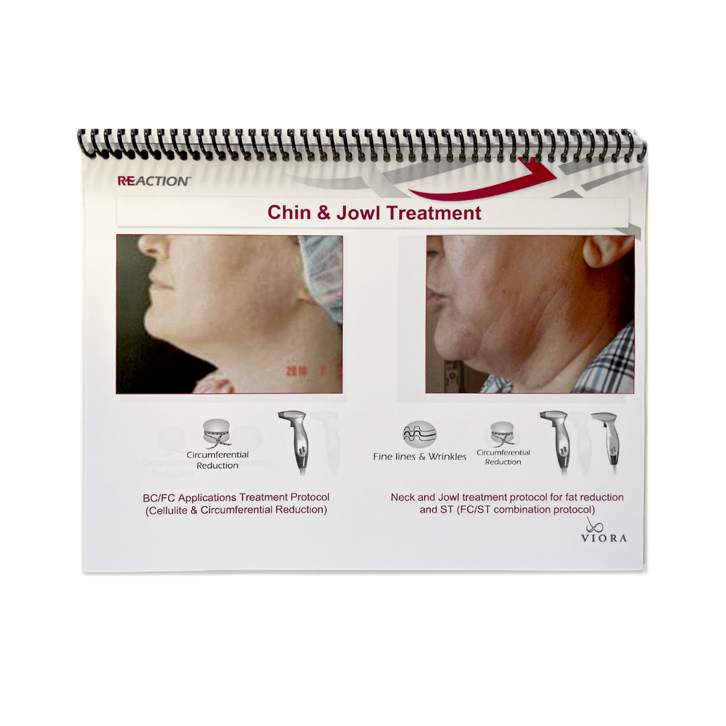 VIORA REACTION, User Manual, Contraindications for Reaction Treatments, P/N: CL-010 Rev. D