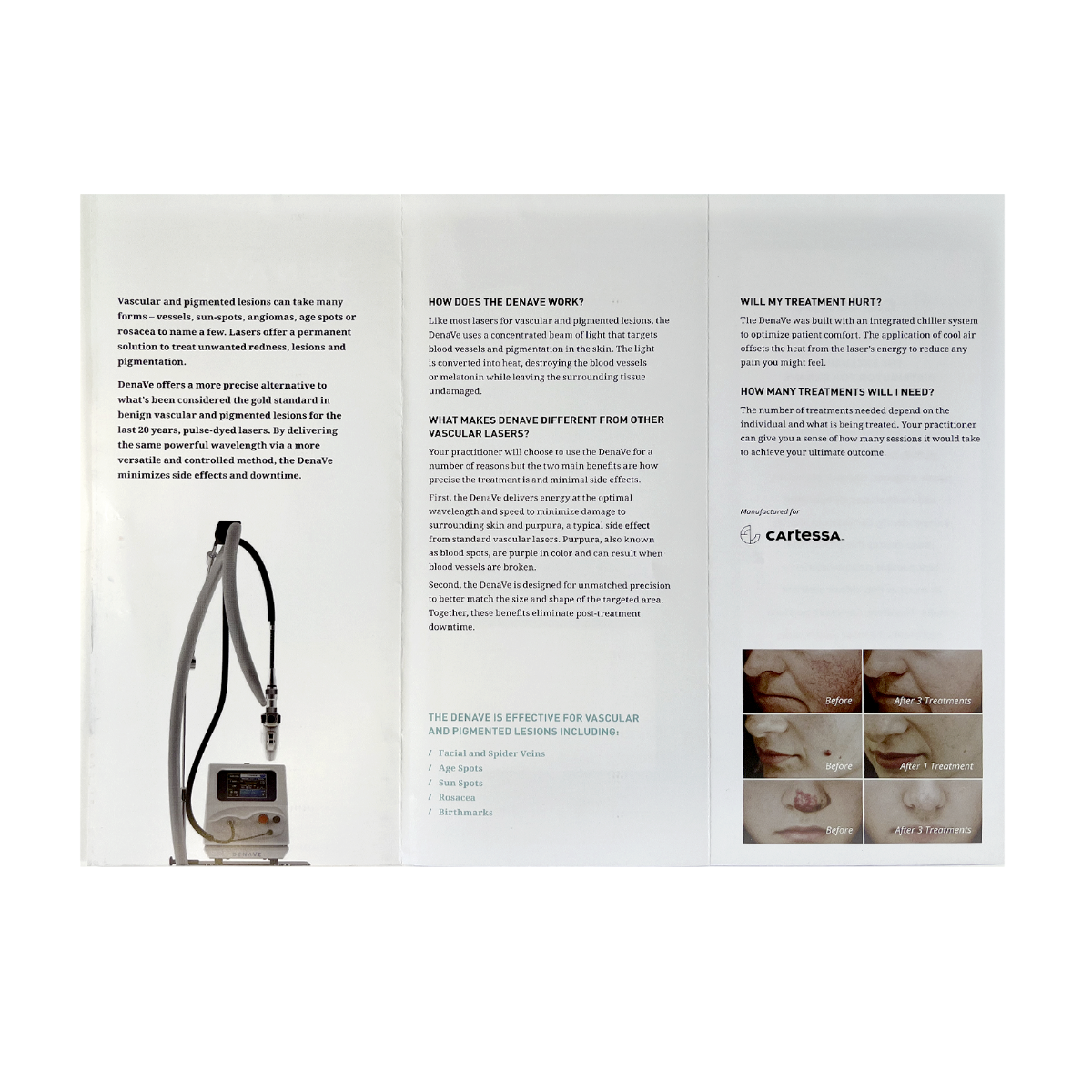 DENAVE “ERASE SKIN IMPERFECTIONS Rosacea – Vessels – Age spots” Brochure