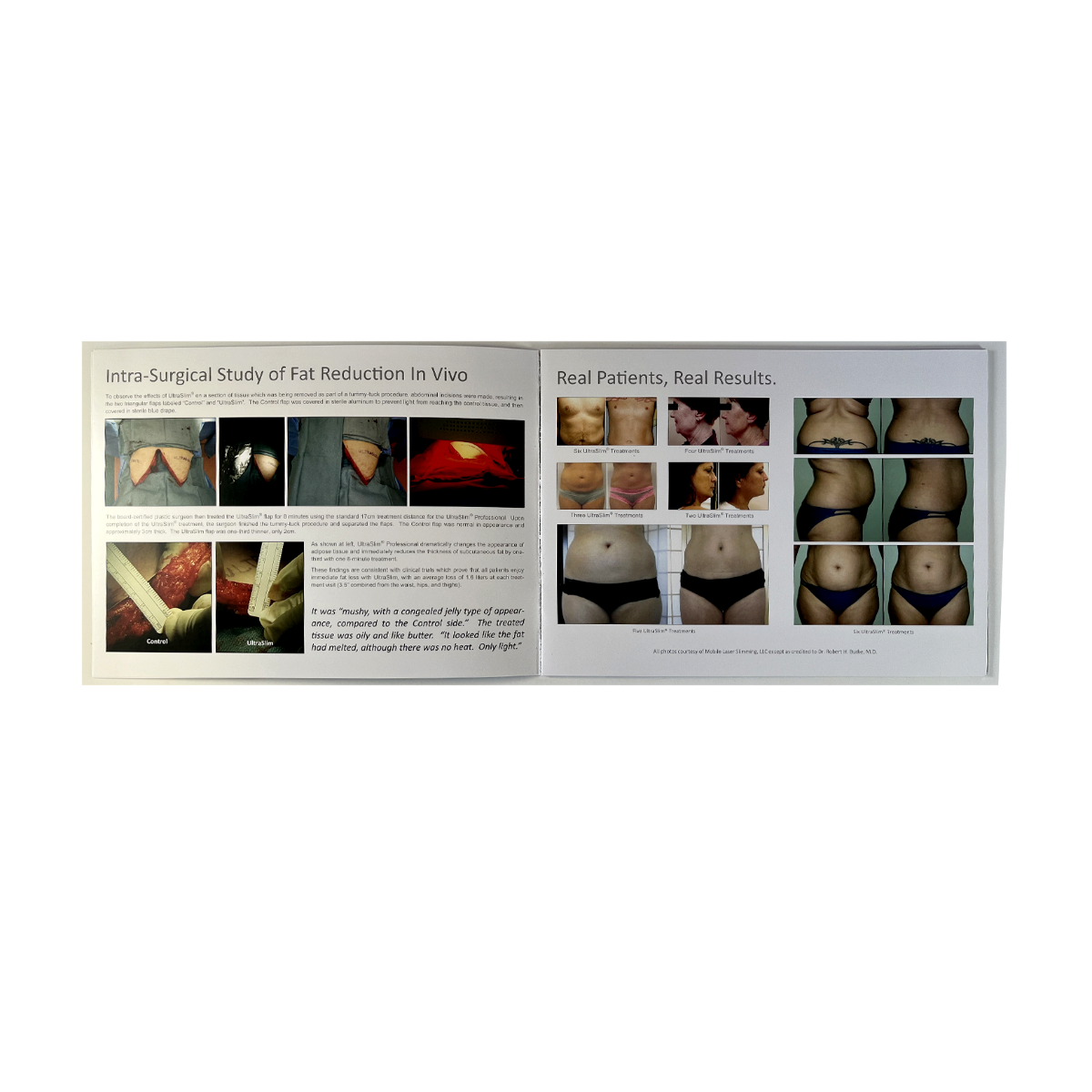UltraSlim Brochure Lose at least 2" today