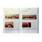 BTL AESTHETICS Clinical Guide EXILIS SYSTEM- 01