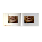 BTL EXILIS SYSTEM 715-74 EXBABOOKEN100- Operator´s Manual