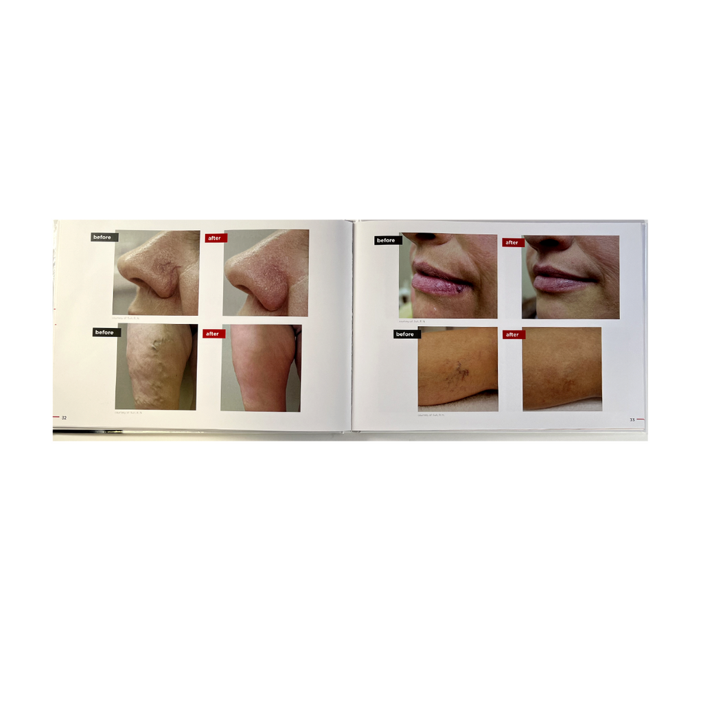 Embrace The Natural New You- Fotona Photo Book-Guide