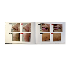Embrace The Natural New You- Fotona Photo Book-Guide