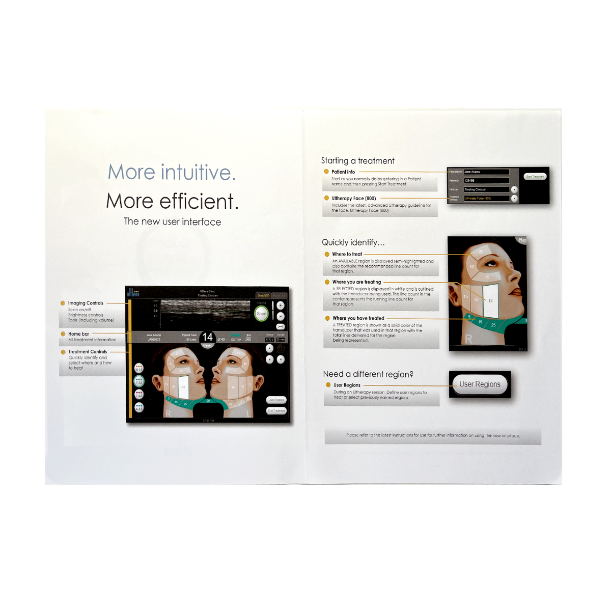 Ulthera, Quick Start Guide, More intuitive, More efficient, the new user interface
