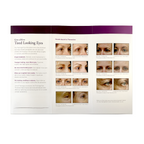 Thermage Skin Tightening for the Eyelids, “see yourself through new eyes, live beautifully” Brochure. MK2025J, 2001 (25 Pack)