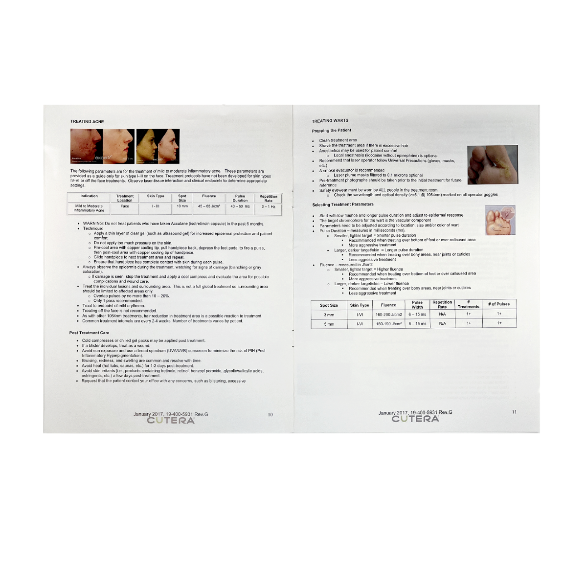Cutera Excel Vascular Treatment Guidelines 19-400-5931 Rev. G 2017