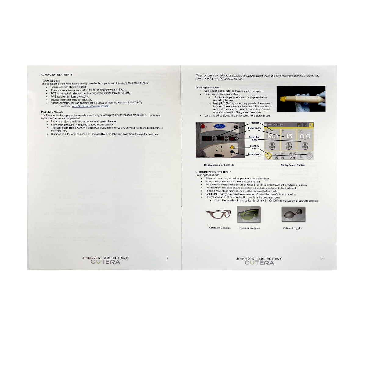 Cutera Excel Vascular Treatment Guidelines 19-400-5931 Rev. G 2017